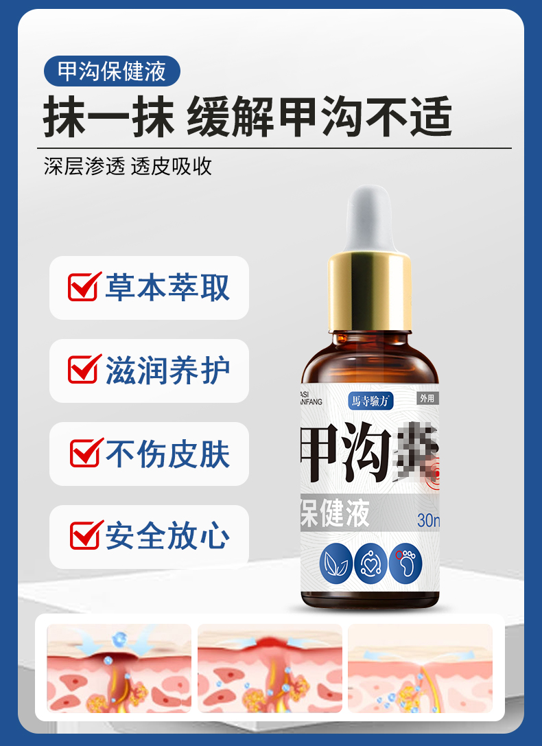 抹一抹，緩解甲溝不適